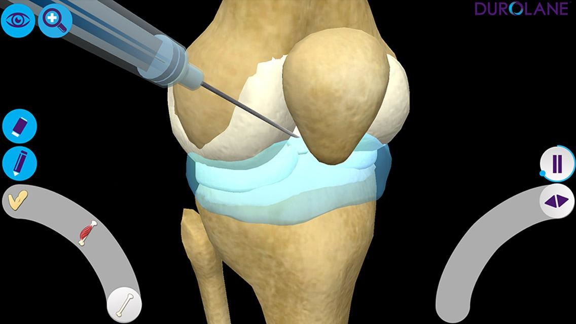 Knee Injection